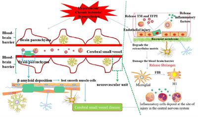 Cerebral Small Vessel Disease: Neuroimaging Features, Biochemical Markers, Influencing Factors, Pathological Mechanism and Treatment